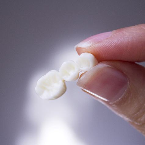 A smiling man elderly man with a dental bridge