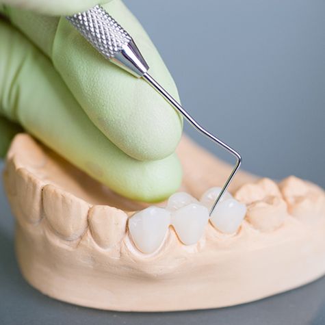 A hand holding a dental bridge