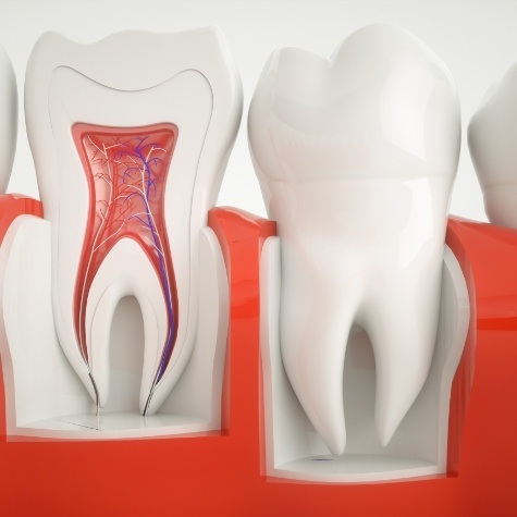 Animated inside of a tooth used to explain root canal therapy