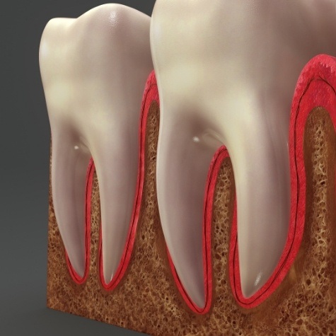 Animated damaged smile before tooth extractions