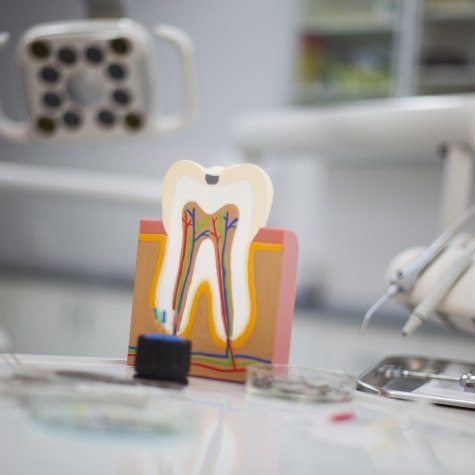 Model tooth used to explain pulp therapy