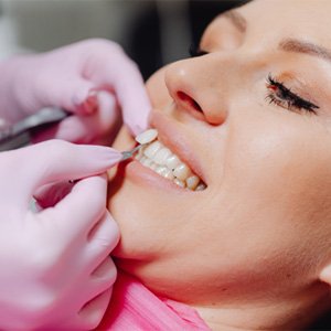 Woman at dentist for veneer consultation