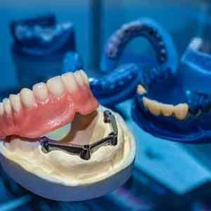 Example of Implanted dentures from Hiner Family Dentistry