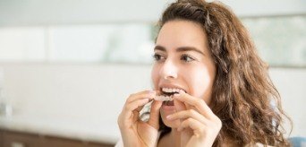 Woman placing an Invisalign orthodontic tray