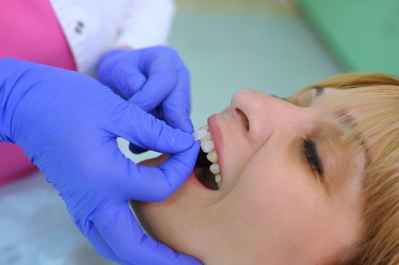 Lady receives veneers